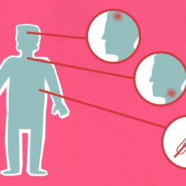 Withdrawal Symptoms: How to Stay Safe During Detox
